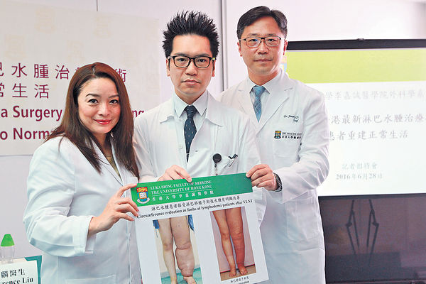 港大新技術 有效治淋巴水腫