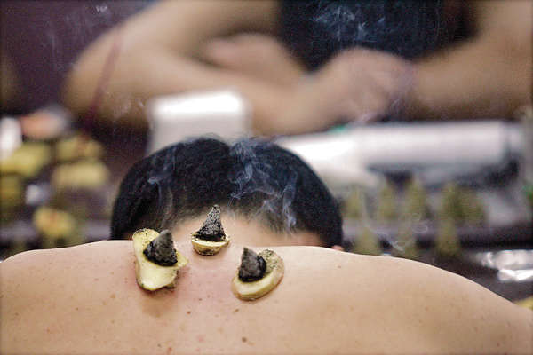 最熱「三伏天」 天灸防病好時機