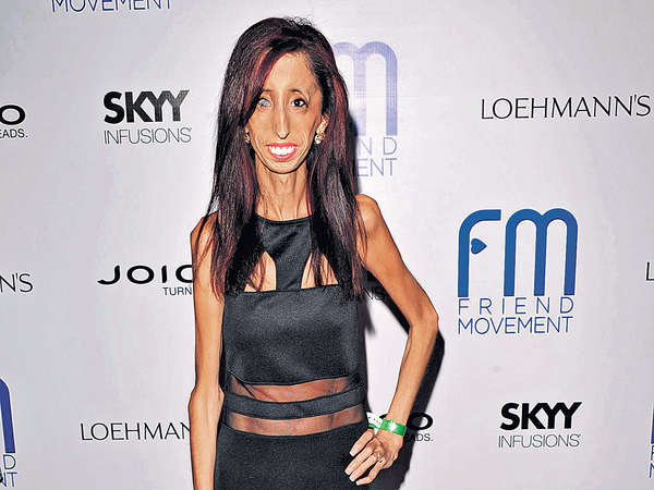 「世界最醜女」 拍片反欺凌