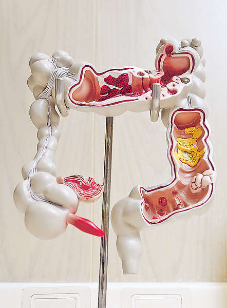 大腸鏡檢查 十年增三倍