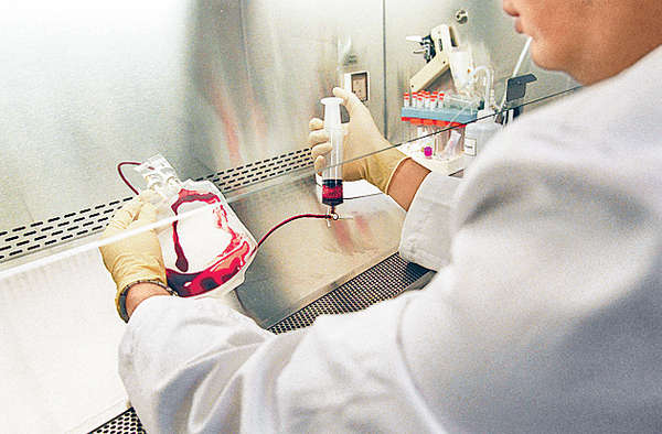 臍帶血幹細胞治自閉