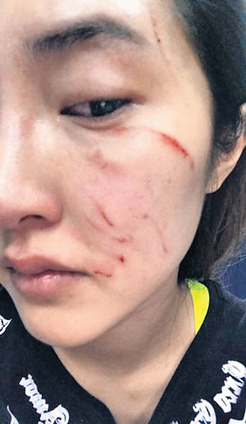 放狗無綁繩起衝突 成都女主播捱打毀容