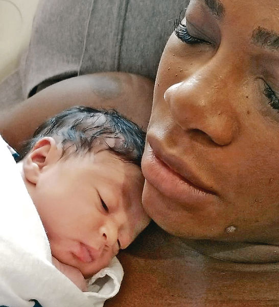 細威囡囡曝光 明年澳網或復出