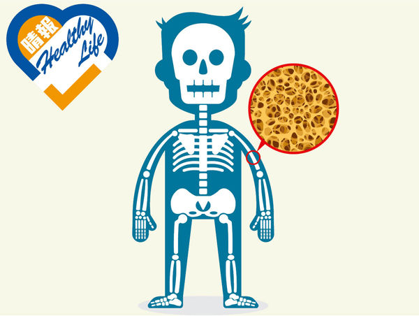 防骨質疏鬆 勿單靠補鈣
