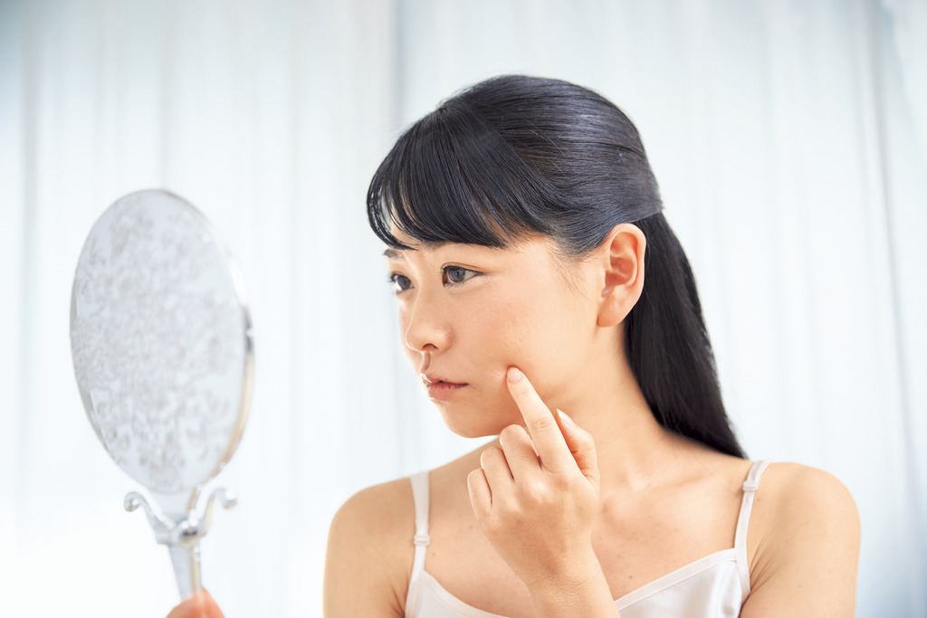 「遠離暗瘡煩惱 按程度及成因選擇適合治療方案」