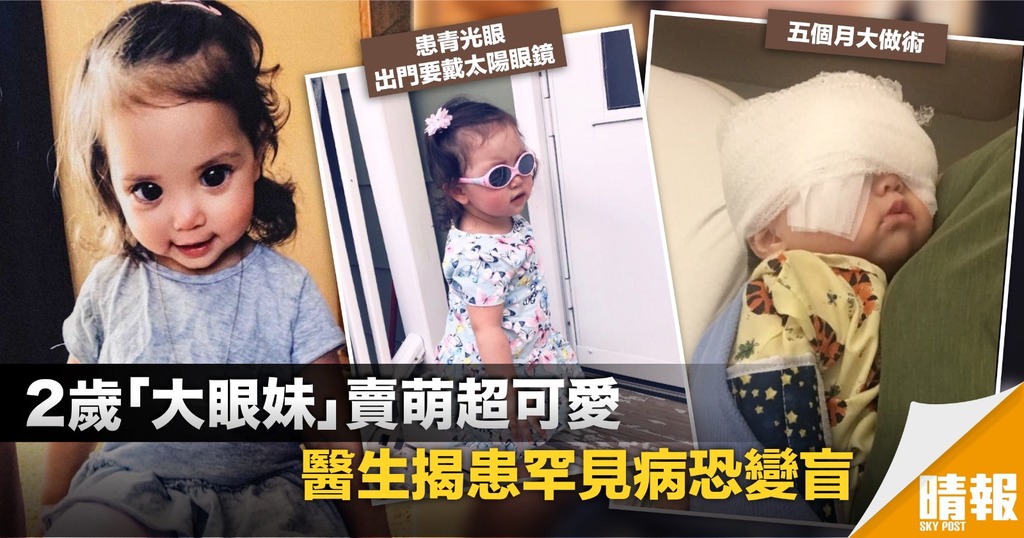 2歲妹妹眼大大超可愛 醫生揭患罕見病隨時盲