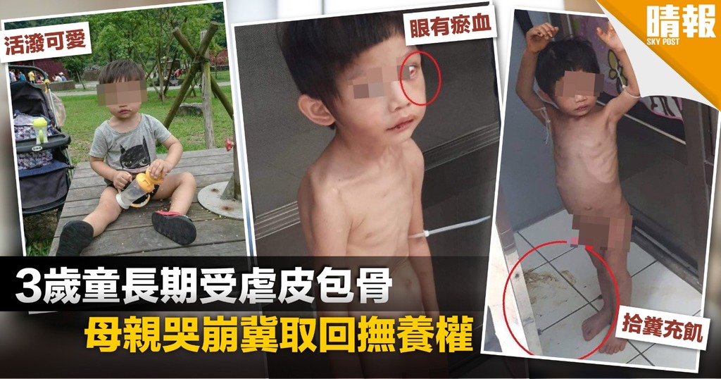 3歲童長期受虐拾糞充肌 生父惹眾怒遭掟蛋