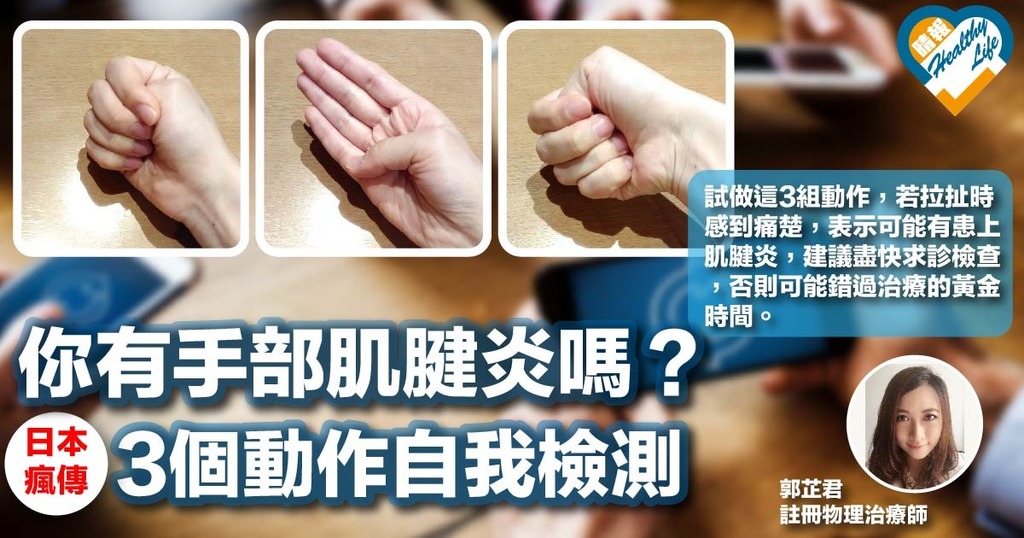 你有手部肌腱炎嗎？日本瘋傳3個動作自我檢測