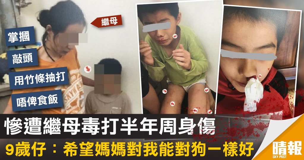 慘遭繼母毒打半年周身傷 9歲仔：希望媽媽對我能對狗一樣好