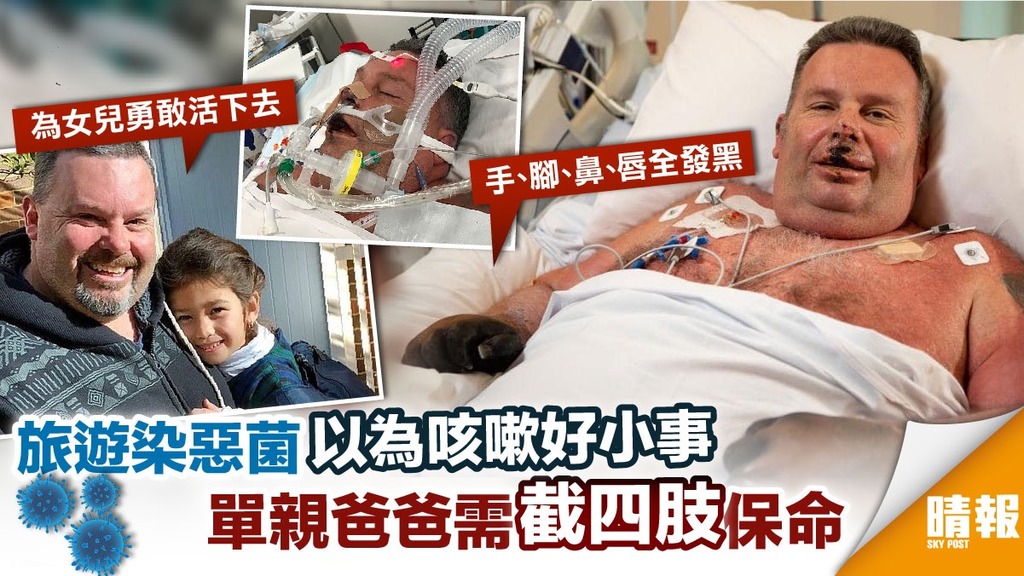 以為咳嗽好小事！單親爸爸旅遊染惡菌 需截四肢保命