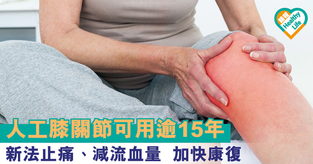 人工膝關節可用逾15年 新法止痛、減流血量 加快康復