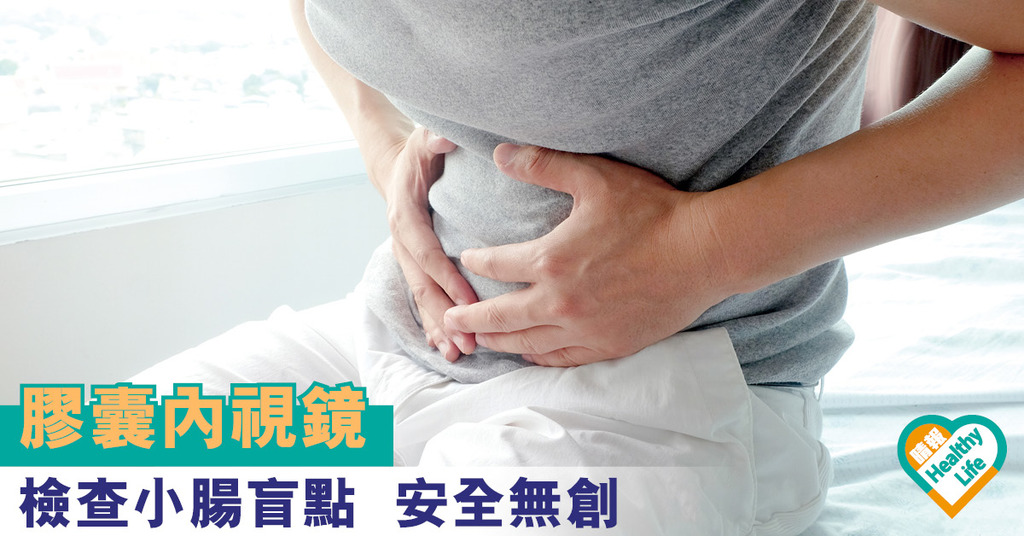 膠囊內視鏡 檢查小腸盲點 安全無創