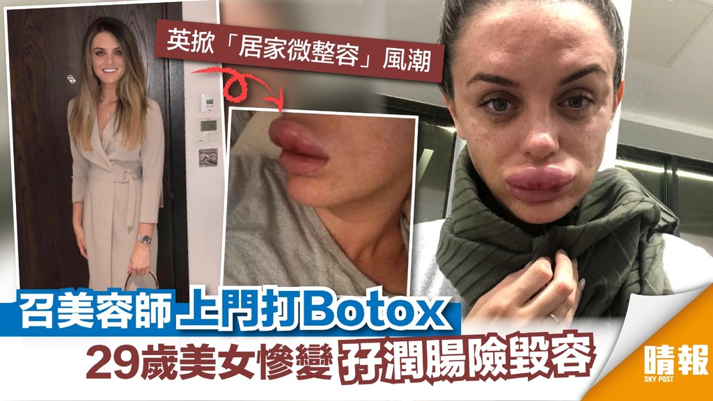召美容師上門打Botox 29歲美女慘變孖潤腸險毀容