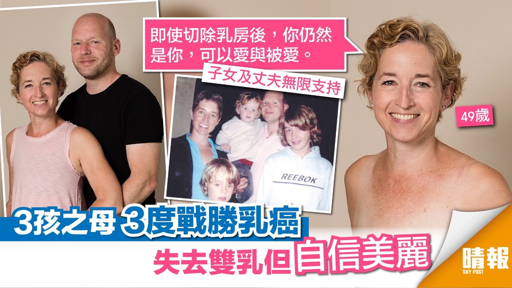 切除雙乳仍自信美麗 乳癌患者：我覺得自己看起來很好