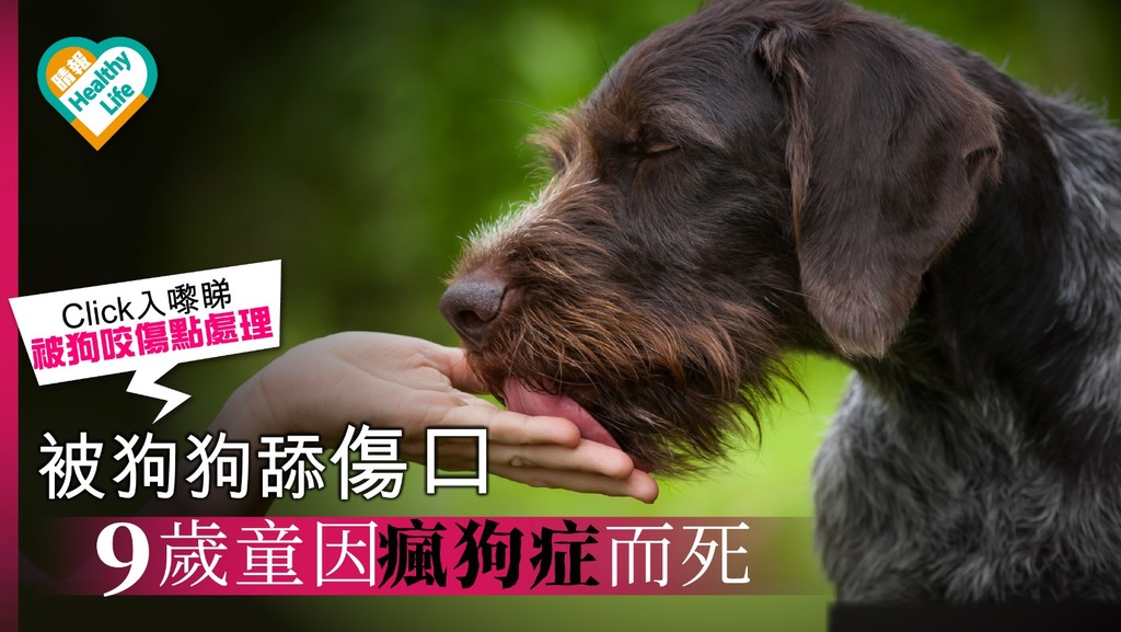 被狗狗舔傷口 9歲童因瘋狗症而死