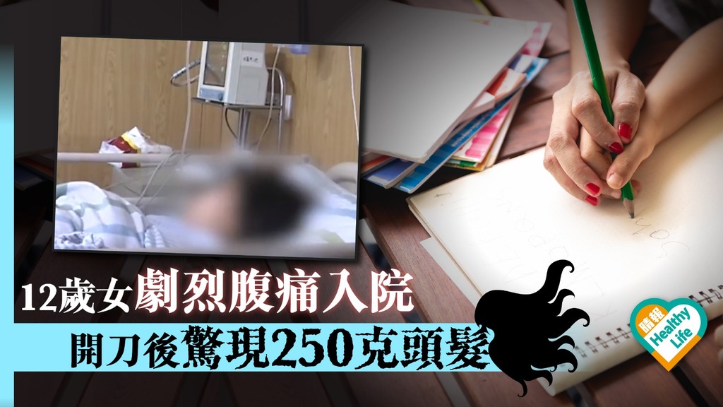 12歲女劇烈腹痛入院 開刀後驚現250克頭髮