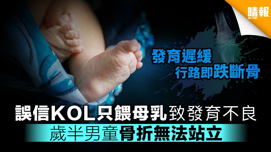 誤信KOL只餵母乳致發育不良 歲半男童骨折無法站立
