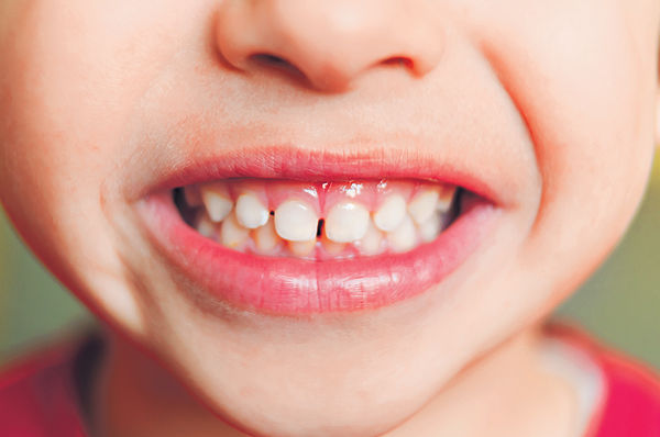 乳齒提取幹細胞 或可治癌