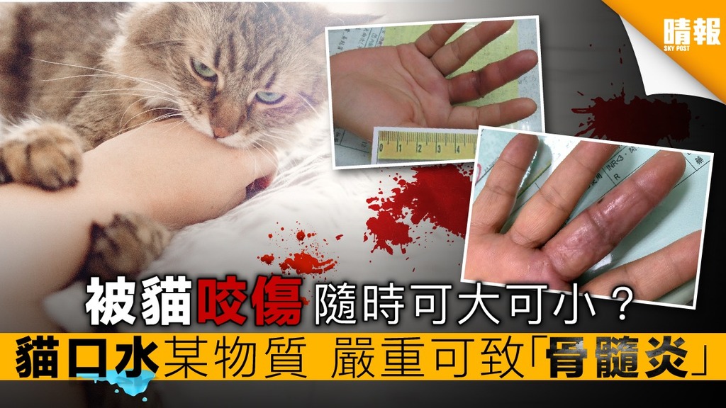 被貓咬傷可致「骨髓炎」 全因貓口水中某物質
