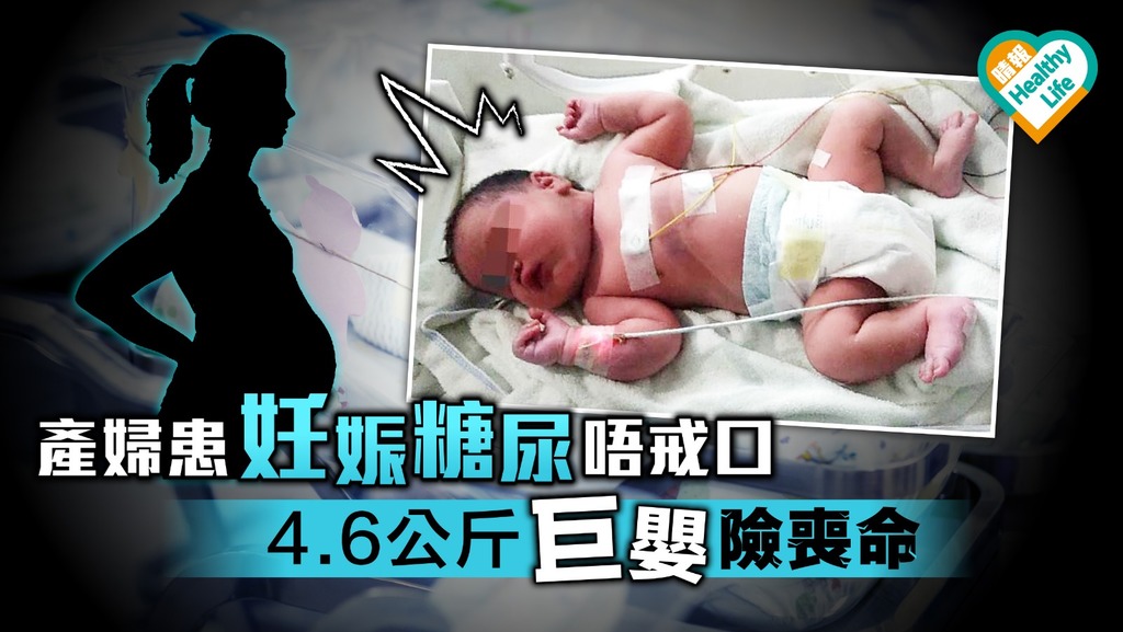 30歲產婦患妊娠糖尿唔戒口 4.6公斤巨嬰險喪命