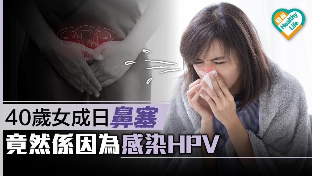 40歲女經常鼻塞 竟然係感染了HPV
