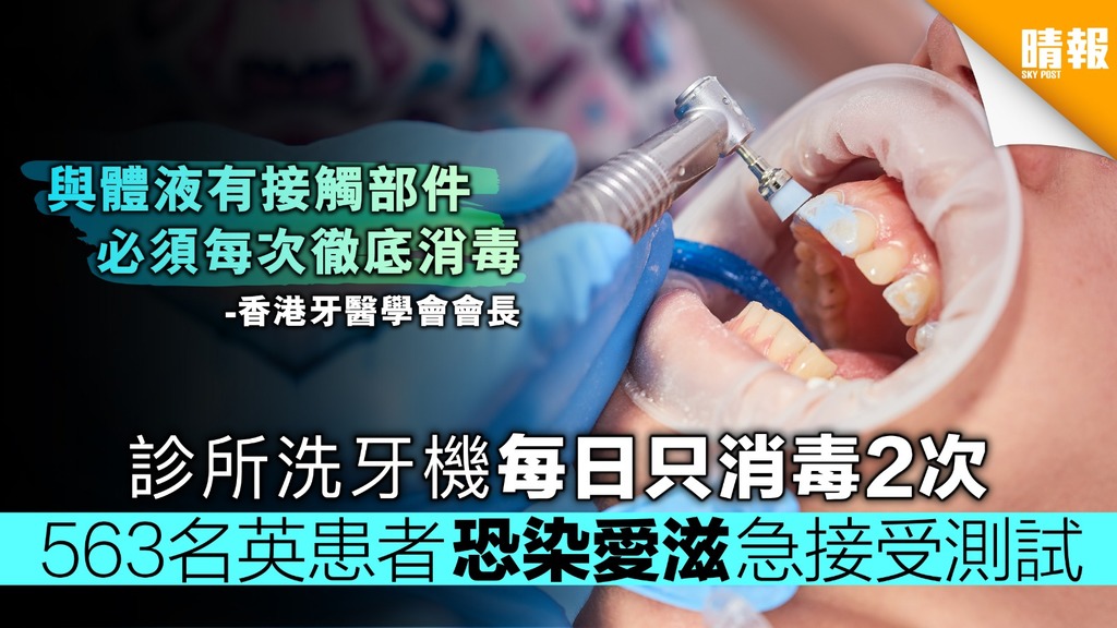 診所洗牙機每日只消毒2次 563名英患者恐染愛滋急接受測試