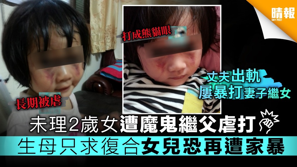 未理2歲女遭魔鬼繼父虐打 生母只求復合女兒恐再遭家暴