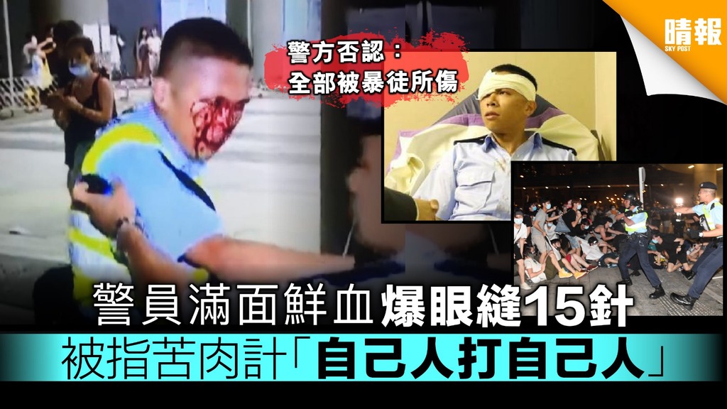 【逃犯條例】警員滿面鮮血爆眼縫15針 被指苦肉計「自己人打自己人」