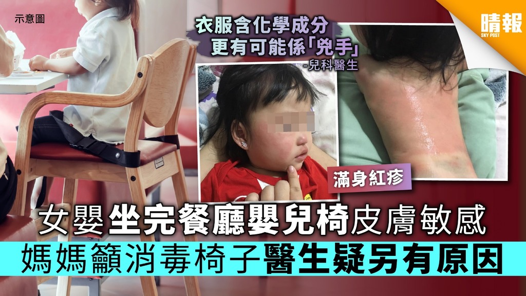 女嬰坐完餐廳嬰兒椅皮膚敏感 媽媽籲消毒椅子醫生疑另有原因