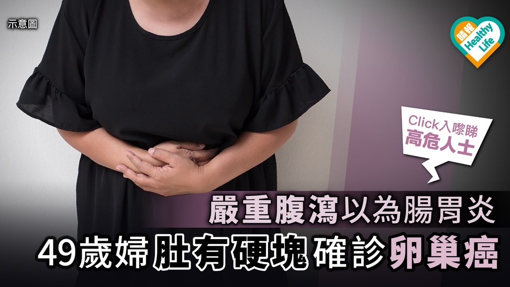 嚴重腹瀉以為腸胃炎 49歲婦肚有硬塊確診卵巢癌