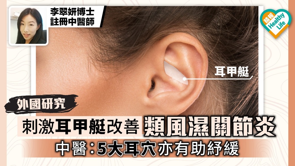 【外國研究】刺激耳甲艇改善類風濕關節炎 中醫：5大耳穴亦有助紓緩