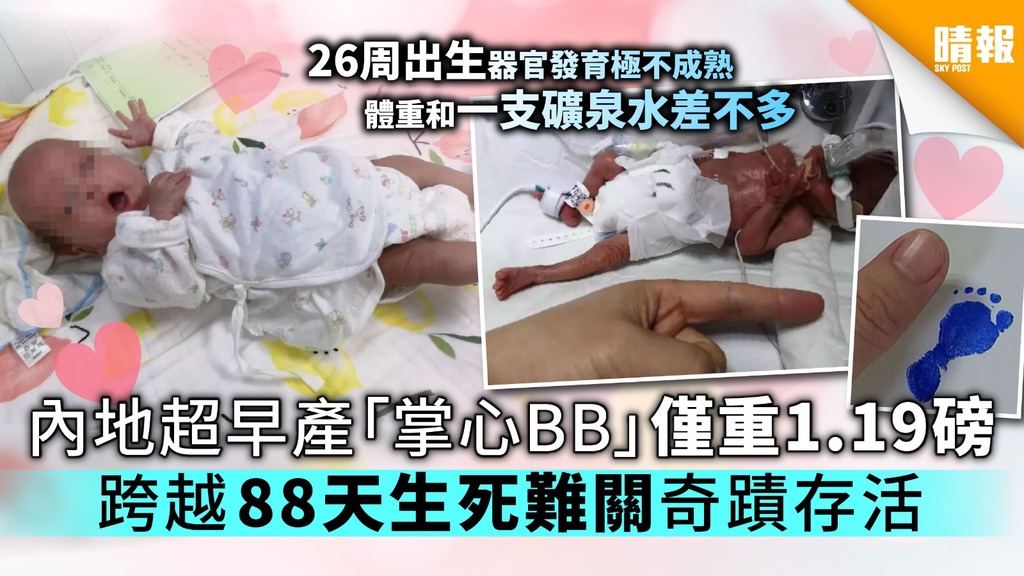內地超早產「掌心BB」僅重540克 跨越88天生死難關奇蹟存活