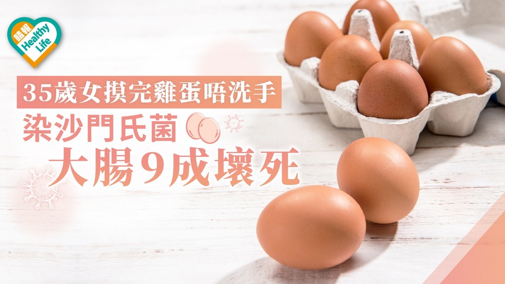 35歲女摸完雞蛋唔洗手 染沙門氏菌大腸9成壞死
