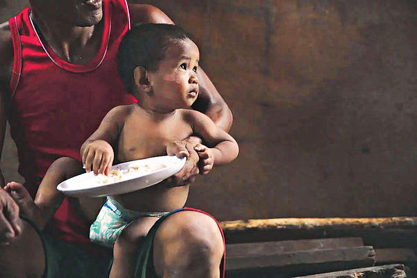 全球三分一幼兒 營養不良或超重