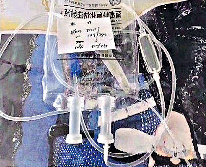 歌手林俊傑入院吊鹽水 針頭疑遭醫護人員拍賣