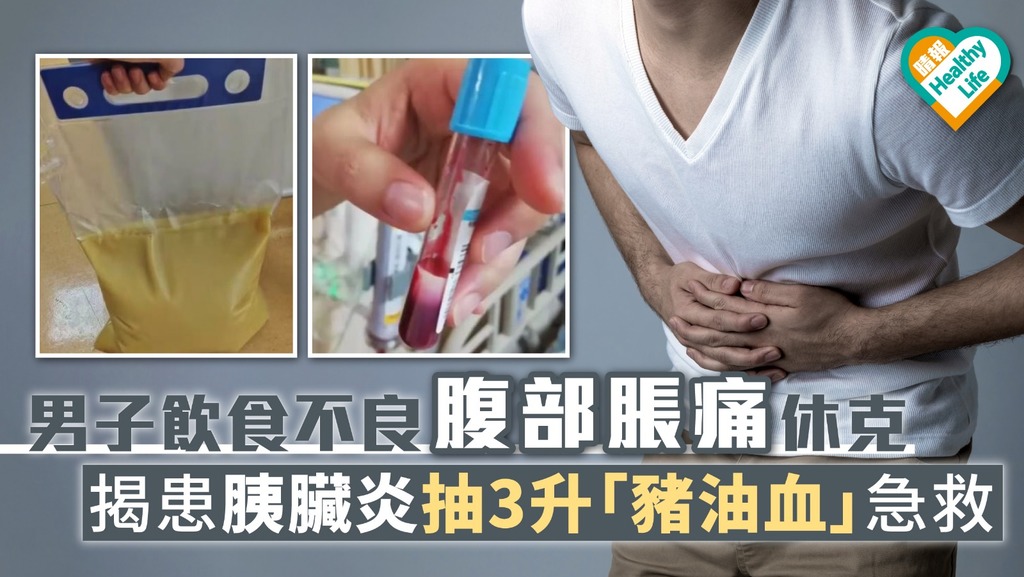 男子飲食不良腹部脹痛休克 揭患胰臟炎抽3升「豬油血」急救