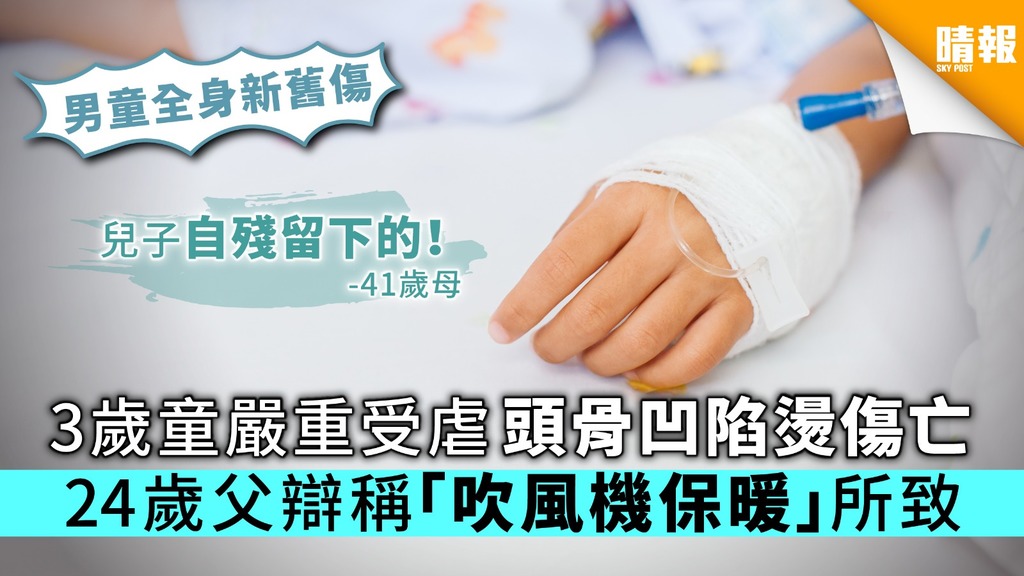 3歲童嚴重受虐頭骨凹陷燙傷亡 24歲父辯稱「吹風機保暖」所致