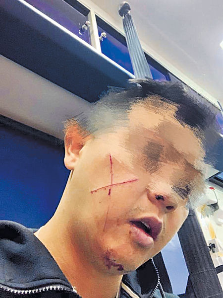 阻疑人毁選舉橫額 休班警遭割傷