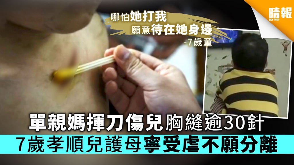 單親媽揮刀傷兒胸縫逾30針 7歲孝順兒護母寧受虐不願分離