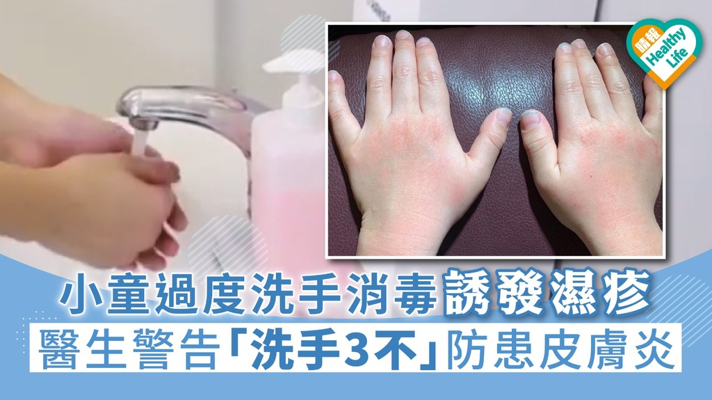 【武漢肺炎】小童過度洗手消毒誘發濕疹 醫生警告「洗手三不」防患皮膚炎