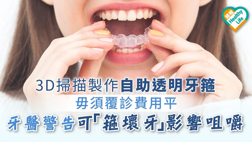 3D掃描製作自助透明牙箍 毋須覆診費用平 牙醫警告可「箍壞牙」影響咀嚼