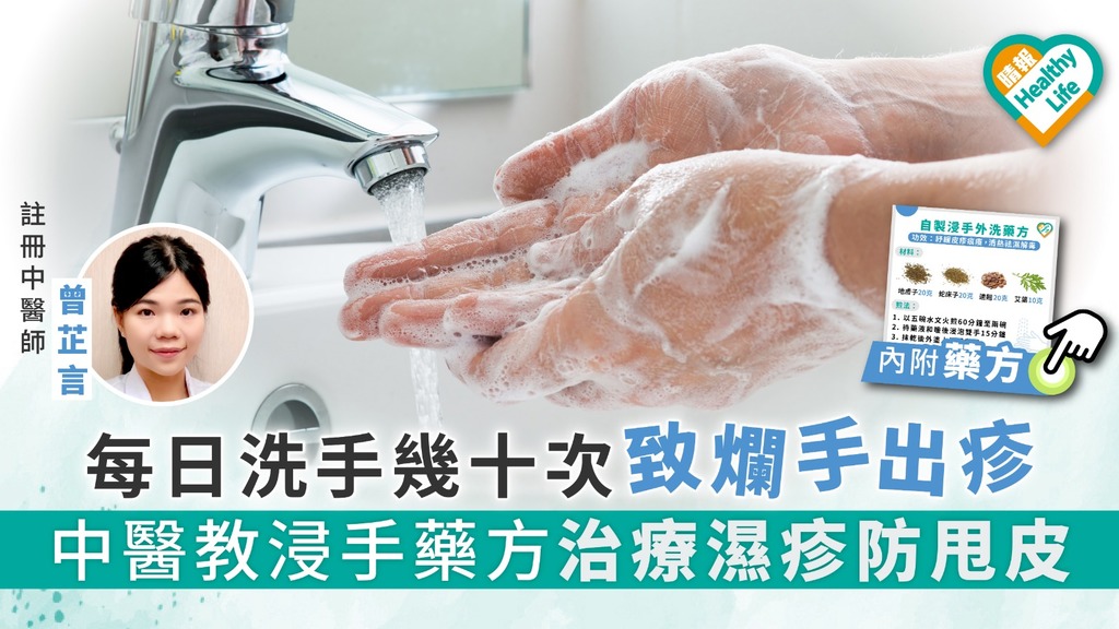 【新冠肺炎】每日洗手幾十次致爛手出疹 中醫教浸手藥方治療濕疹防甩皮