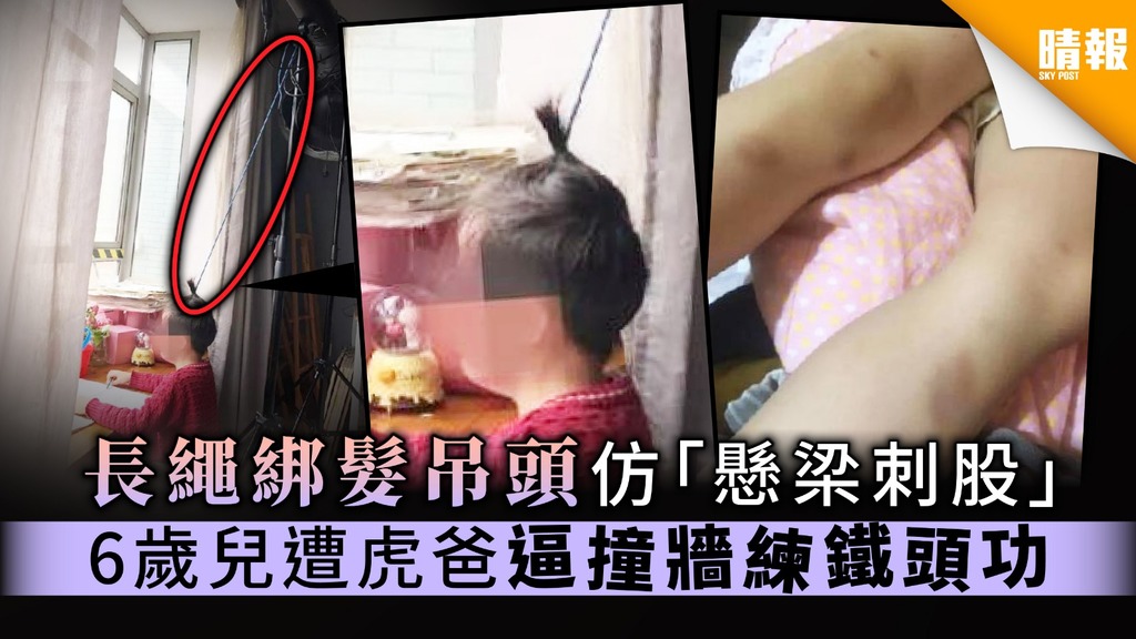 【稚子何辜】長繩綁髮吊頭仿「懸梁刺股」 6歲兒遭虎爸逼撞牆練鐵頭功