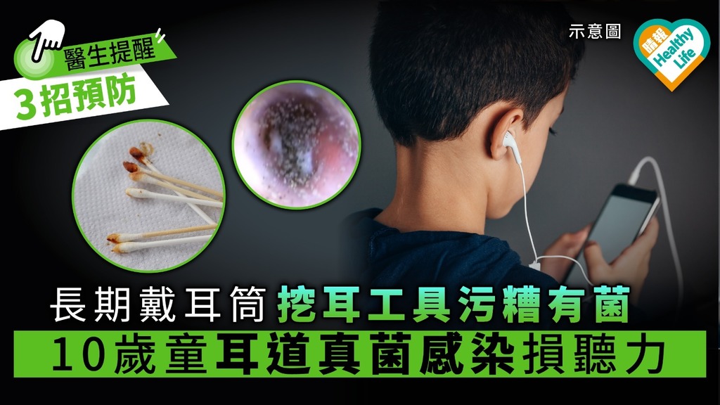 【耳朵發霉】長期戴耳筒挖耳工具污糟有菌 10歲童耳道真菌感染損聽力