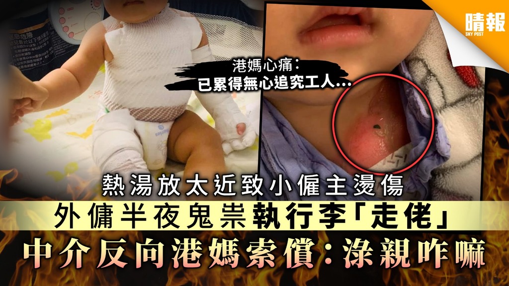 【恐怖外傭】熱湯放太近致小僱主燙傷 外傭半夜鬼祟執行李離開 中介反向港媽索償：淥親咋麻