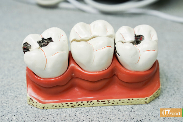 第一、牙齒的疾病。如蛀牙十分嚴重，牙齒容易變成黃色或黑色。