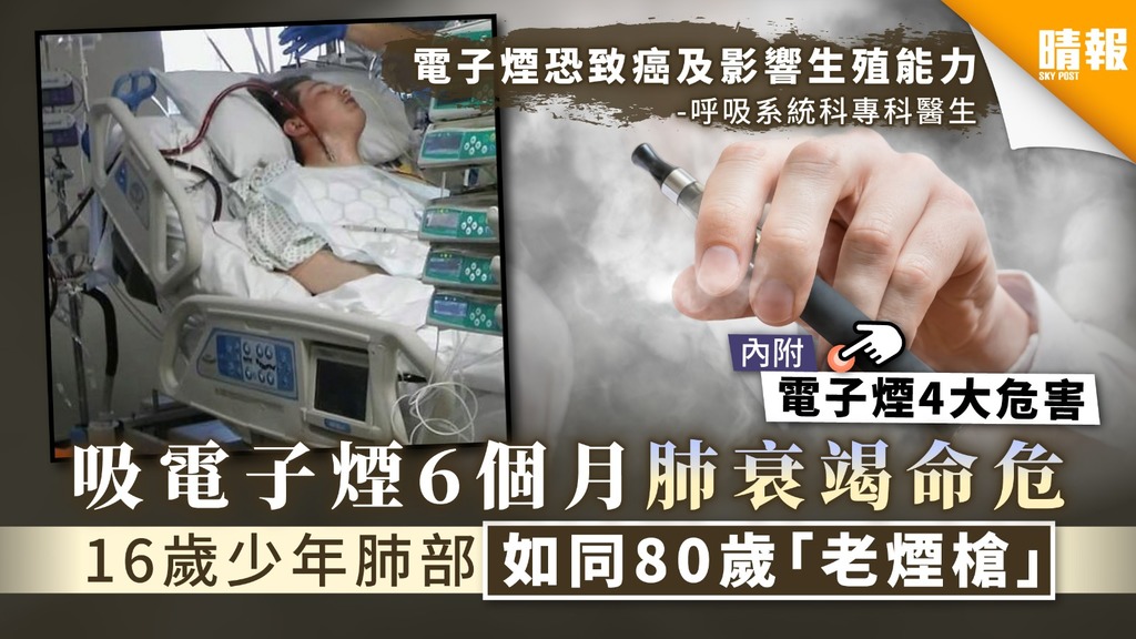 【損害健康】吸電子煙6個月肺衰竭命危 16歲少年肺部如同80歲「老煙槍」【附電子煙4大危害】