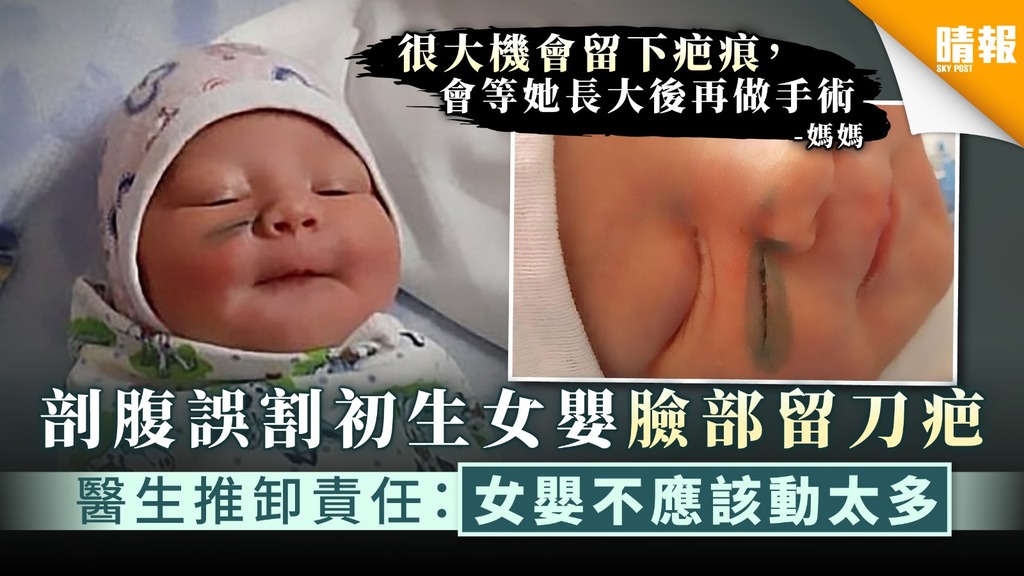 【醫療事故】剖腹誤割初生女嬰臉部留刀疤 醫生推卸責任：女嬰不應該動太多