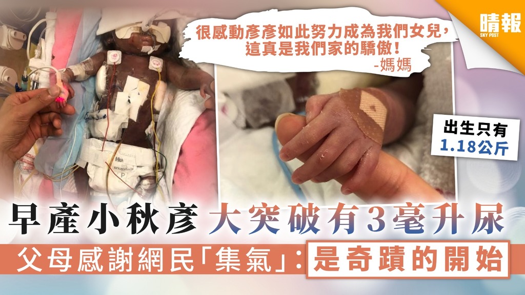 【生命小鬥士】早產小秋彥大突破有3毫升尿 父母感謝網民「集氣」：是奇蹟的開始