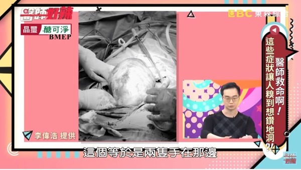 21歲女長期打嗝食量變少拖半年突腹脹如懷孕揭生腫瘤 晴報 健康 女性疾病 D0928